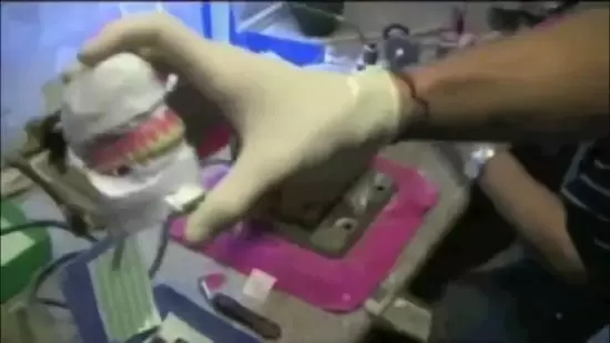 Doctors Upgrade Porn Star Lethal Lipps Fake Teeth For Better