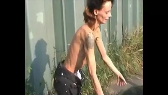 Lesbian Anorexic Skinny Girls